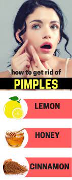Lemon Honey And Cinnamon Remedies To Get Rid Of Pimple Marks Lemon Pimples Pimpleremedies Pi How To Get Rid Of Pimples Pimple Marks How To Remove Pimples