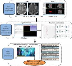 Moreover, we added the list of the most popular conversions for visualization and the history table with exchange rate diagram for 162 euro (eur) to romanian leu (ron) from sunday, 06/12/2020 till sunday, 29/11/2020. Better Efficacy In Differentiating Who Grade Ii From Iii Oligodendrogliomas With Machine Learning Than Radiologist S Reading From Conventional T1 Contrast Enhanced And Fluid Attenuated Inversion Recovery Images Bmc Neurology Full Text
