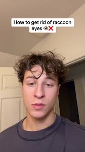 This is the only thing that got rid of my eye bags #ttshop #TikTokShop  #eyebags #darkcircles #raccooneyes