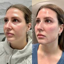 Cydney Brown BSN, RN (@cosmeticnursecydney) • Instagram photos and videos