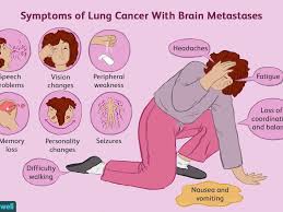 This may cause headaches or even seizures. Lung Cancer Spread To The Brain Treatments And Prognosis