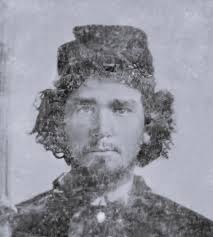 Soldier survives head wound in civil war