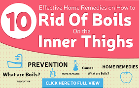 Looking for a natural home remedy or treatment for boils on the skin? 12 Home Remedies To Get Rid Of Boils On The Inner Thighs