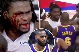 LeBron James ejected after bloodying Pistons' Isaiah Stewart