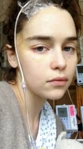 In 2013, Ibrahim Yücel, a man from Kütahya, Turkey, took an extreme step to  quit smoking after his father passed away from lung cancer. He constructed  a cage-like helmet made from 130