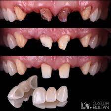 Pin On Teeth