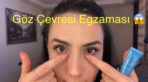 Goz Egzamasi Nasil Gecer Youtube