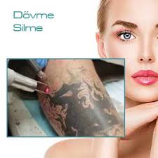 Hakkında detaylı bilgiler ve dovme hangi bolgelere dovme hangi bolgelere yapilmalidir? Dr Zeynep Kirker Medikal Estetik Poliklinigi Dovme Silme Renkli Ve Siyah Dovme Silme