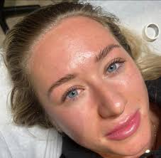 GLO By Anabel Hassocks