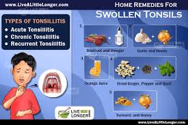 Pin On Remedies