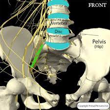 South Coast Spine Radiculopathy