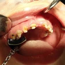 We did not find results for: Dental Report Finds Only Half Of All Australians Brush Their Teeth Twice A Day Abc News