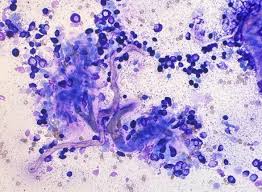 Image result for mastocytoma in dogs