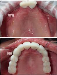 When you visit our santa clara dental office, your smile and oral health is our top priority. Perfect Smile Dental In Tijuana Mexico Read 39 Reviews