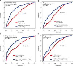 Urine Tmprss2 Erg Fusion Transcript Stratifies Prostate