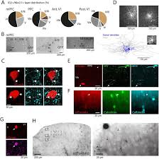 Anatomical features of deep and superficial cortical ID2/Nkx2.1...