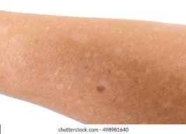 White Spots High Res Stock Images Shutterstock