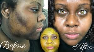 The nervousness in your voice is caused by your fight or flight response kicking in. 5 Day Turmeric Face Mask Cleared My Hyperpigmentation Im Shook Find My Recipes