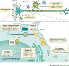 News a mechanism for how the disease als evolves has been discovered at umeå university. Amyotrophic Lateral Sclerosis Nature Reviews Disease Primers