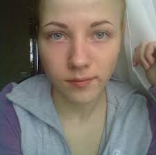 Otvety Mail Ru U Menya Nekrasivaya Vneshnost Nos Kartoshkoj Guby Tonkie Rot Bolshoj I Shirokij Lob Chto Mne Delat