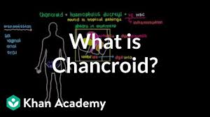 Image result for chancroid