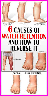 Water retention is particularly common among dieters and the culprit is often you can reduce cortisol levels by simply taking some time each day to relax, take a nap, listen to some good music, drink some tea, do some deep. Pin On My Healthy Board P Health