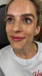 Suzana Marku, NP-C (@urban.aesthetics.np) • Instagram photos and videos