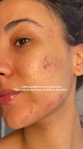 Do you break out more