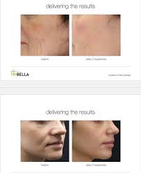 Dr. Aymen Atallah MD