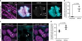 Check spelling or type a new query. Spatially And Temporally Defined Lysosomal Leakage Facilitates Mitotic Chromosome Segregation Nature Communications