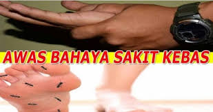 Sapa yang perlu alami situasi ni pasti tau betapa. Mak Solat Petua Hilangkan Kebas Kebas Tangan Dan Kaki Facebook