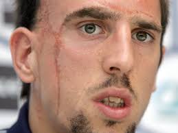 Zu beginn seiner karriere musste ribery eine zeit lang zusätztlich zu seiner tätigkeit als fussballer auf dem bau arbeiten um sich geld nebenbei auch noch geld zu verdienen. Franck Ribery Fc Bayern Munchen