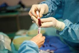 Ada dua jenis sumsum tulang: Seperti Ini Prosedur Transplantasi Sumsum Tulang Belakang