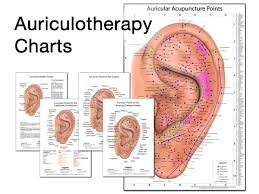 Auricular