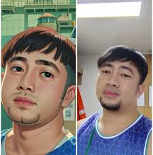 Ano Ang Mga Sintomas ng Myoma? Ang myoma ay isang benign o noncancerous na  paglago o pagdamit ng smooth muscle sa uterus ng isang babae. Tandaan na  hindi ito malignant na kanser.