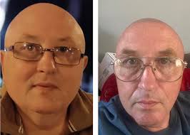 Carnivore Diet For Beginners