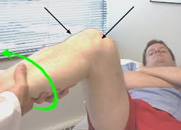 Image result for PCL Sulcus Test