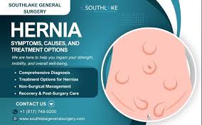 Image result for stomach hernia symptoms
