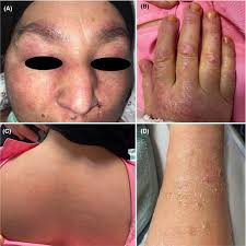 Clinical Case Reports: Vol 9, No 10