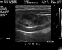 How long do medium dog breeds live? Thyroid Tumors In Dogs And Cats Sciencedirect