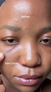 Instant eye zone perfection Using the @KSECRET GLOBAL retinal eye cre...