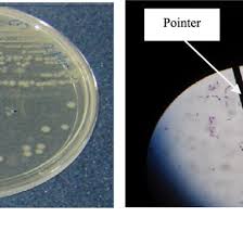 The Bacterial Identification A Colony Morphology In Agar