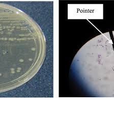 the bacterial identification a colony morphology in agar