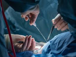 Additionally, other respiratory viruses including influenza a virus, influenza b virus, and respiratory syncytial virus were also examined. Guideline Change Reduces Repeat Surgeries For Women With Breast Cancer Shots Health News Npr