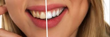 Dec 10, 2019 · while your teeth naturally yellow as you age, some things can help prevent stains on your teeth. 11 Foods That Stain The Teeth