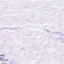 Image result for Polybutester