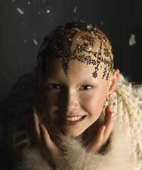 Henna Crowns Restore Confidence To Women Experiencing Hair Loss Good News Network Hair Loss Women Heal Hair Hair