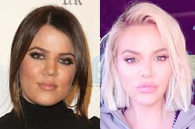 Khloe kardashian is opening up more about the photo controversy that made headlines earlier this week. Khloe Kardashian Plastic Surgery Before And After Who Magazine