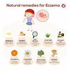 Perhaps the must fun remedy for dermatitis is a beach trip. Natural Remedies For Eczema Treatment By Dt Neha Suryawanshi Lybrate