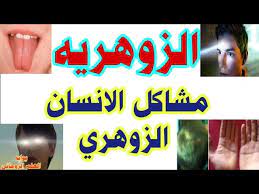 1,688 likes · 19 talking about this. Ø§Ù„Ø²ÙˆÙ‡Ø±ÙŠÙ‡ ÙˆÙ…Ø´Ø§ÙƒÙ„ Ø§Ù„Ø¥Ù†Ø³Ø§Ù† Ø§Ù„Ø²ÙˆÙ‡Ø±ÙŠ Youtube
